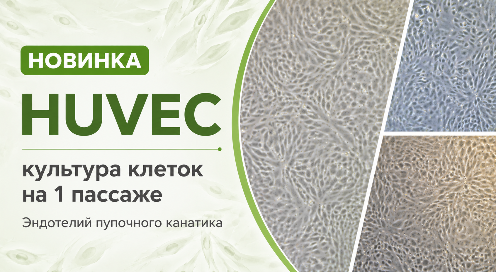 Новинка — HUVEC, культура клеток на первом пассаже