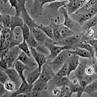 MNNG-HOS (TE 85, clone F-5)